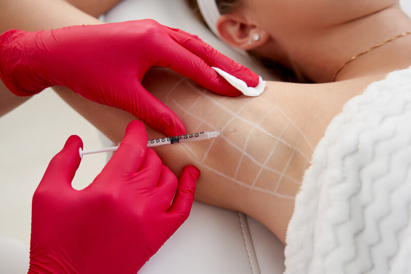 Doctor makes injections of botulinum toxin in the underarm area against hyperhidrosis in beauty salon. Female cosmetology and problems with increased sweating concept