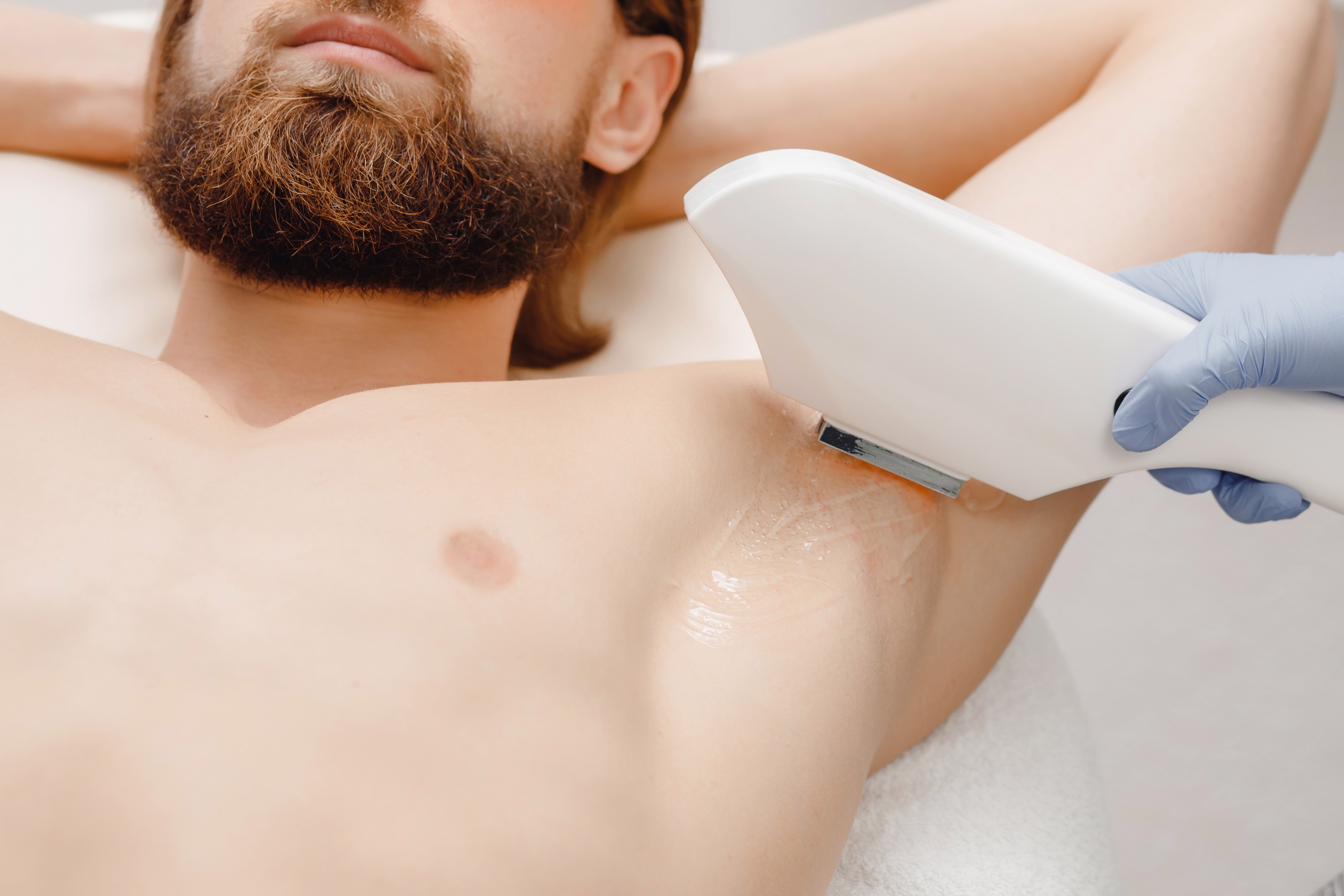 Diode Laser Hair Removal Edmonton | Revive Cosmetic Clinic