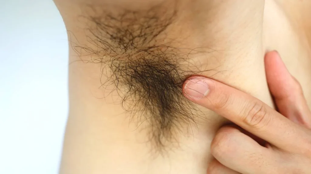 How to Get Rid of Armpit Hair Without Shaving