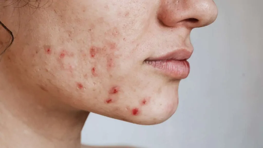 Blotchy Skin Causes, Conditions & Solutions for Every Area