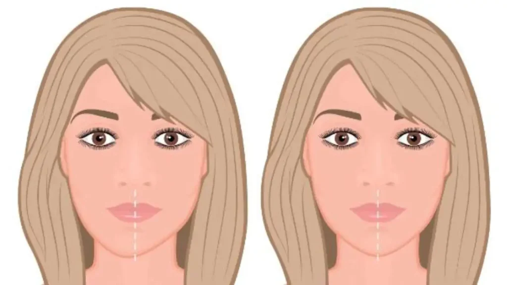 How to Fix Facial Asymmetry