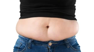 How to Treat & Remove a Pot Belly